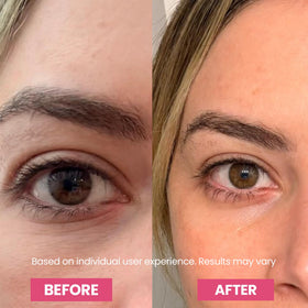 Luxe Korean Under Eye Balm applied on skin