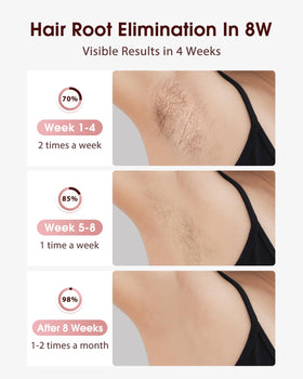 LYSMOSKI IPL Hair Removal Device showing ice cooling feature