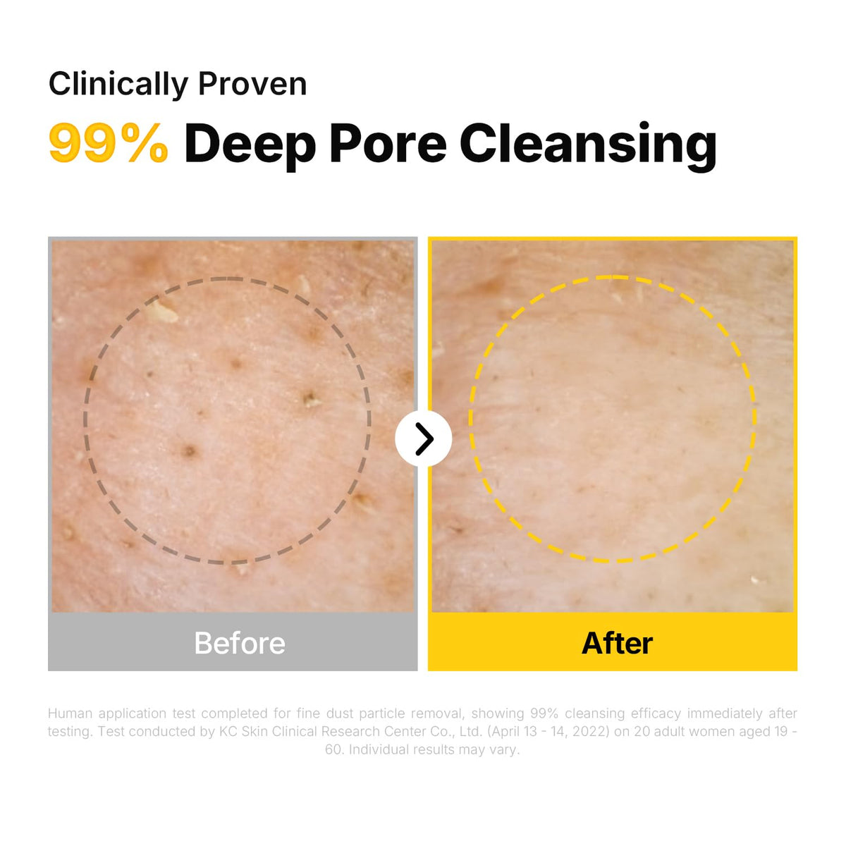 ma:nyo Pure Cleansing Oil 200ml with makeup removal cotton pads