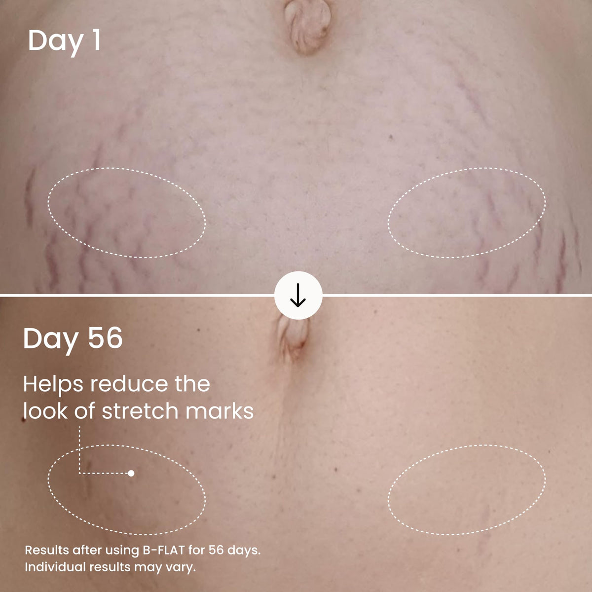 MAËLYS B-FLAT Belly Firming Cream application on skin