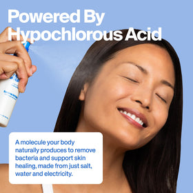 Magic Molecule Skin Spray 8oz in use on skin