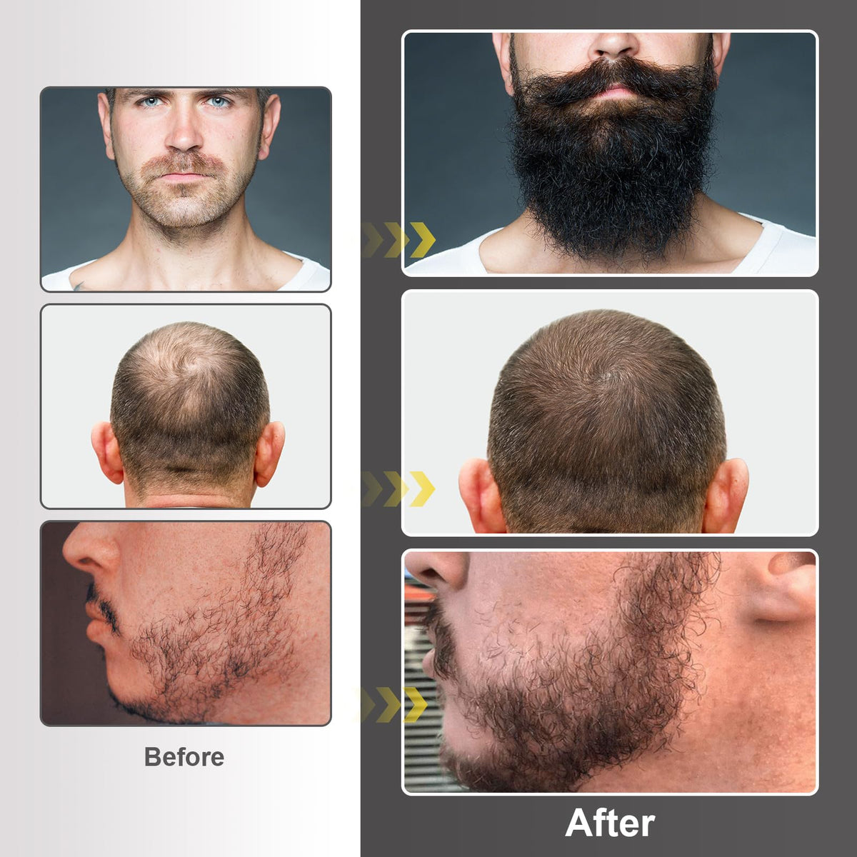 Man applying beard oil from Naland kit