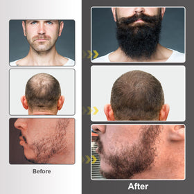 Man applying beard oil from Naland kit