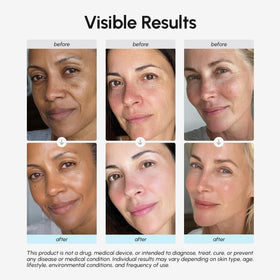 MAREE Face Moisturizer Retinol Cream packaging