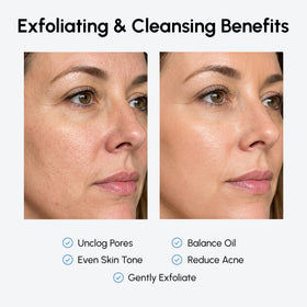 MAREE Glycolic Acid Pads 20% with ingredients listed