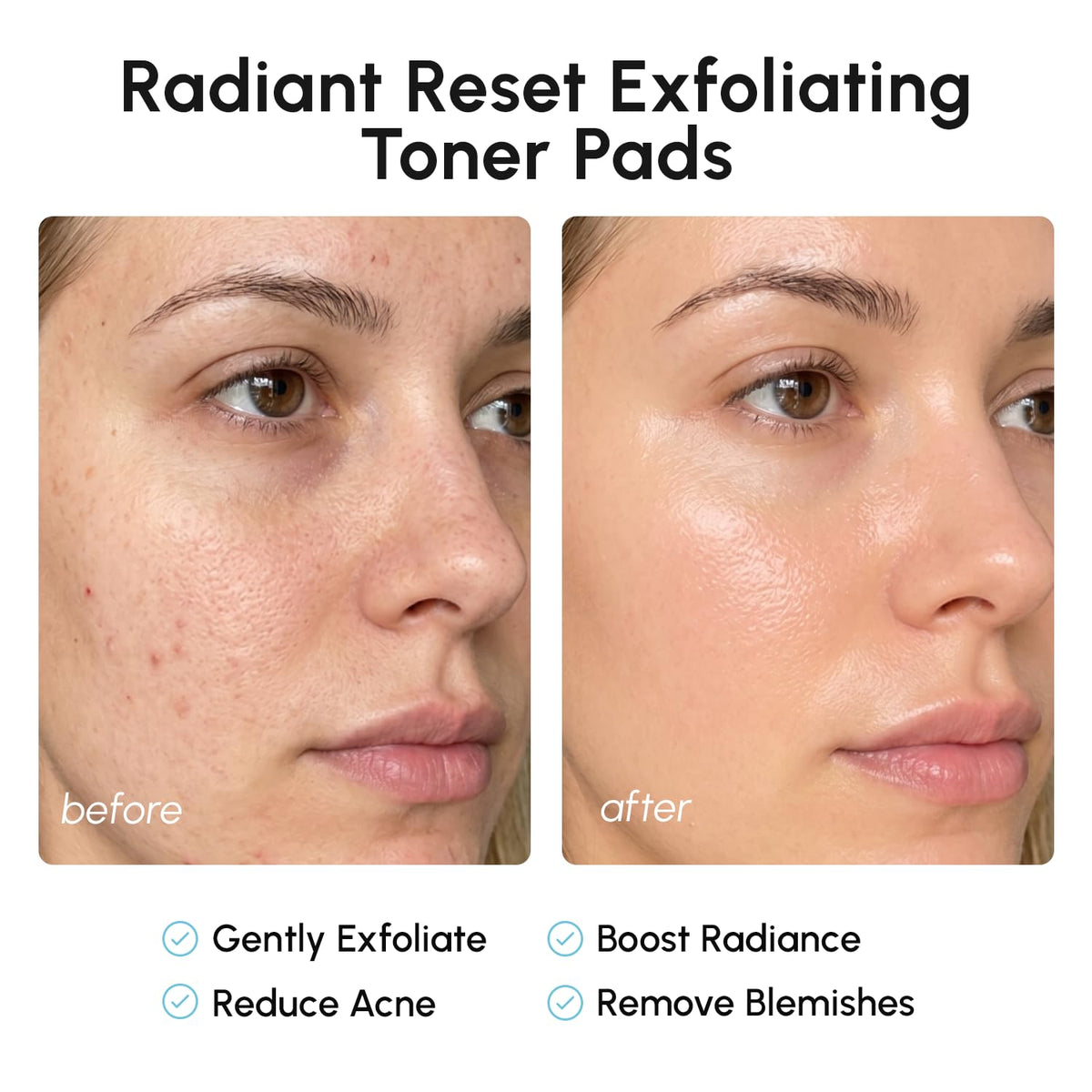MAREE Glycolic Acid Pads with ingredients displayed