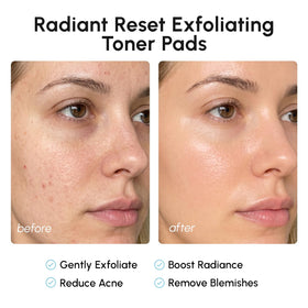 MAREE Glycolic Acid Pads with ingredients displayed