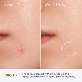 MAREE Invisible Pimple Patches back view packaging