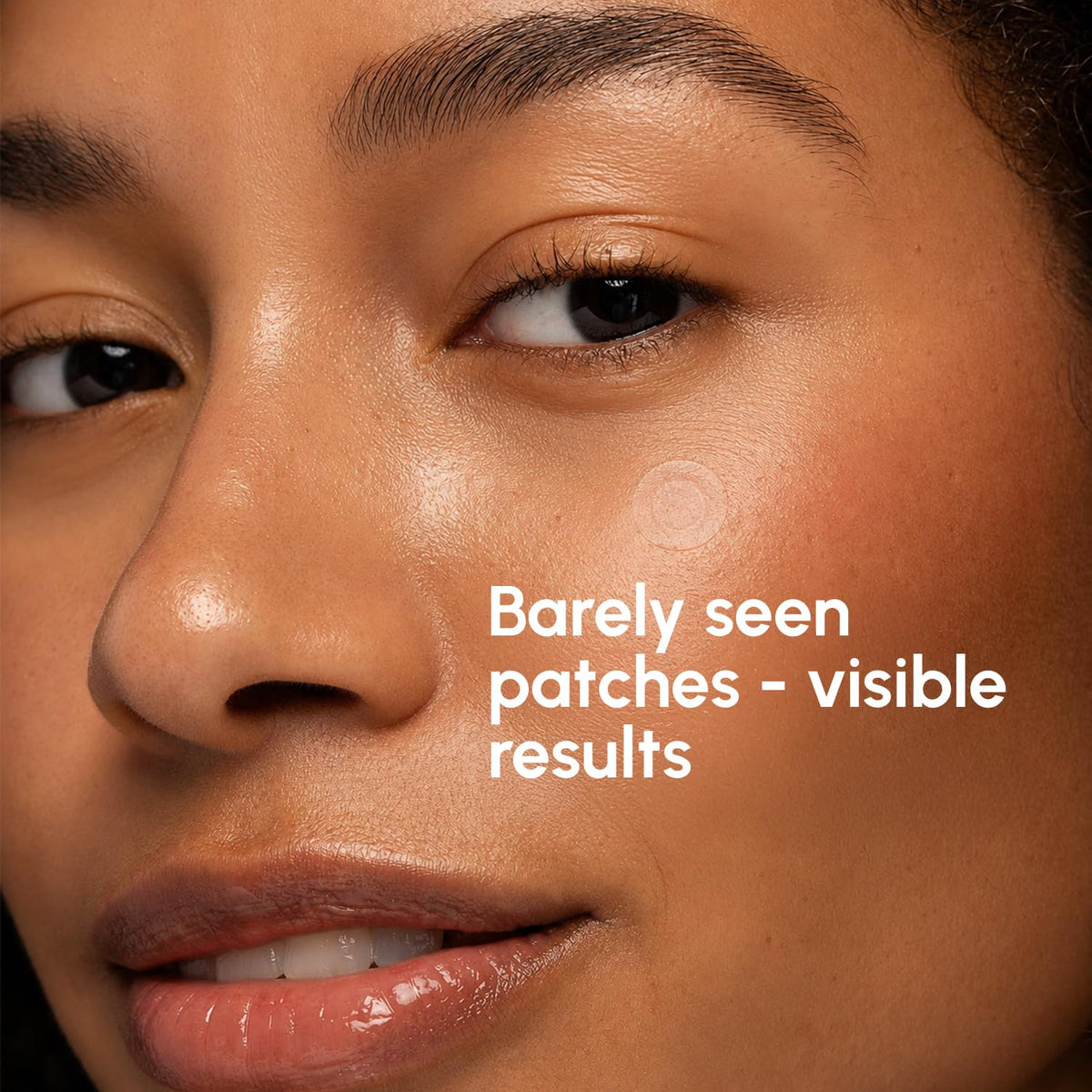 MAREE Invisible Pimple Patches close-up of patches