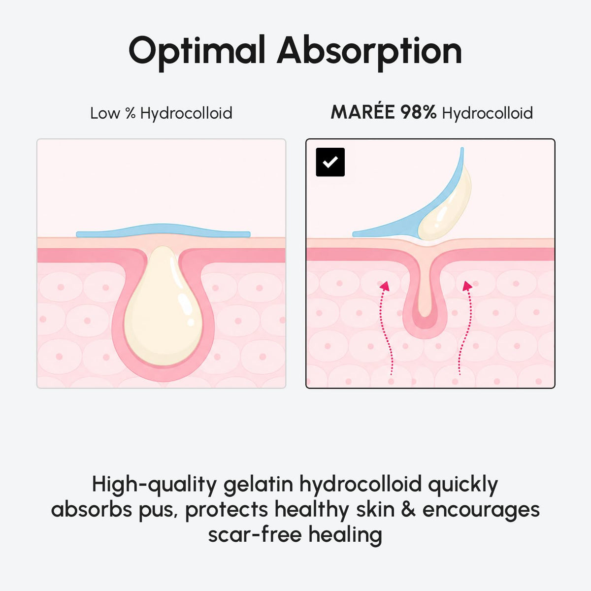 MAREE Invisible Pimple Patches showing two sizes
