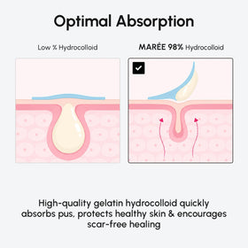 MAREE Invisible Pimple Patches showing two sizes