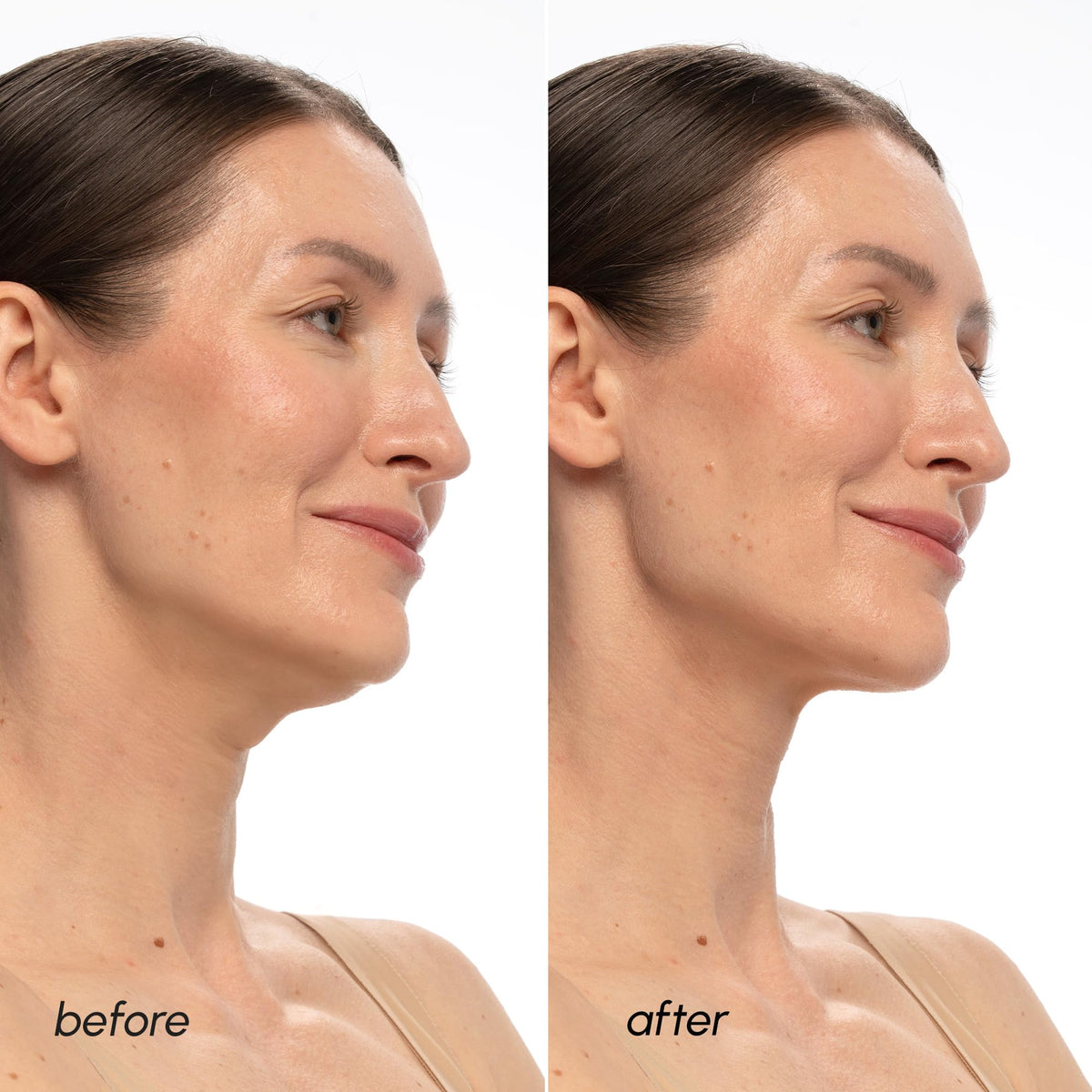 MAREE V Line Lifting Mask with PDRN Salmon DNA ingredients