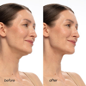 MAREE V Line Lifting Mask with PDRN Salmon DNA ingredients