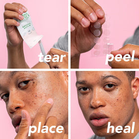 Mario Badescu Blemish Kit contents displayed