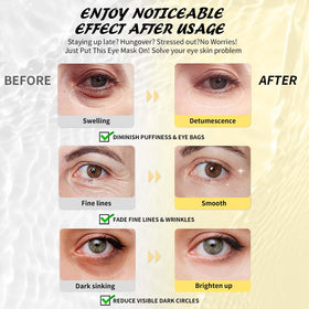 Maskiss Retinol Under Eye Patches application on model