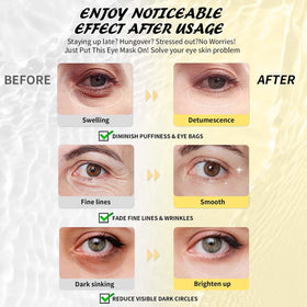 Maskiss Under Eye Patches applied on a model's face
