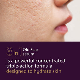 Mederma Scar Serum side view