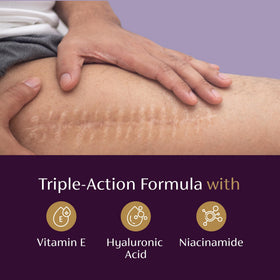 Mederma Scar Serum with Vitamin E and Niacinamide ingredients