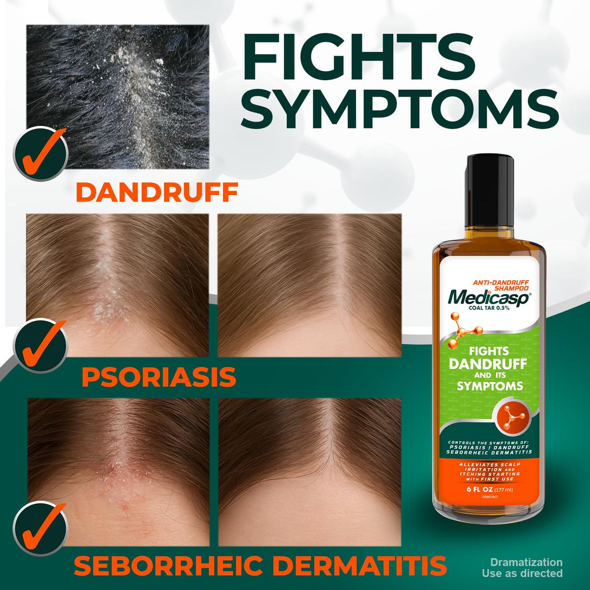 Medicasp Coal Tar Anti-Dandruff Shampoo application on wet hair