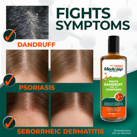 Medicasp Coal Tar Anti-Dandruff Shampoo application on wet hair
