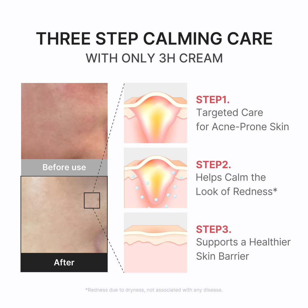 medicube 3H Daily Relief Cream application on skin