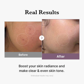 medicube Age-R Glutathione Glow Milky Toner in lifestyle setting