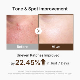 medicube Capsule Cream application on skin