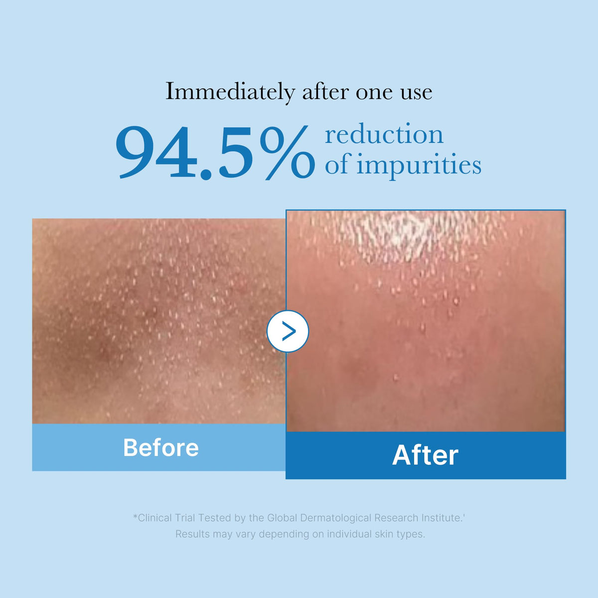 medicube Cleansing Oil Zero Pore Blackhead bottle side view