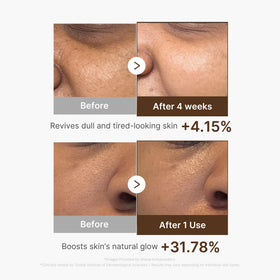 medicube Deep Vitamin C Capsule Serum application on hand