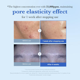 medicube Exosome Shot Zero Facial Serum packaging