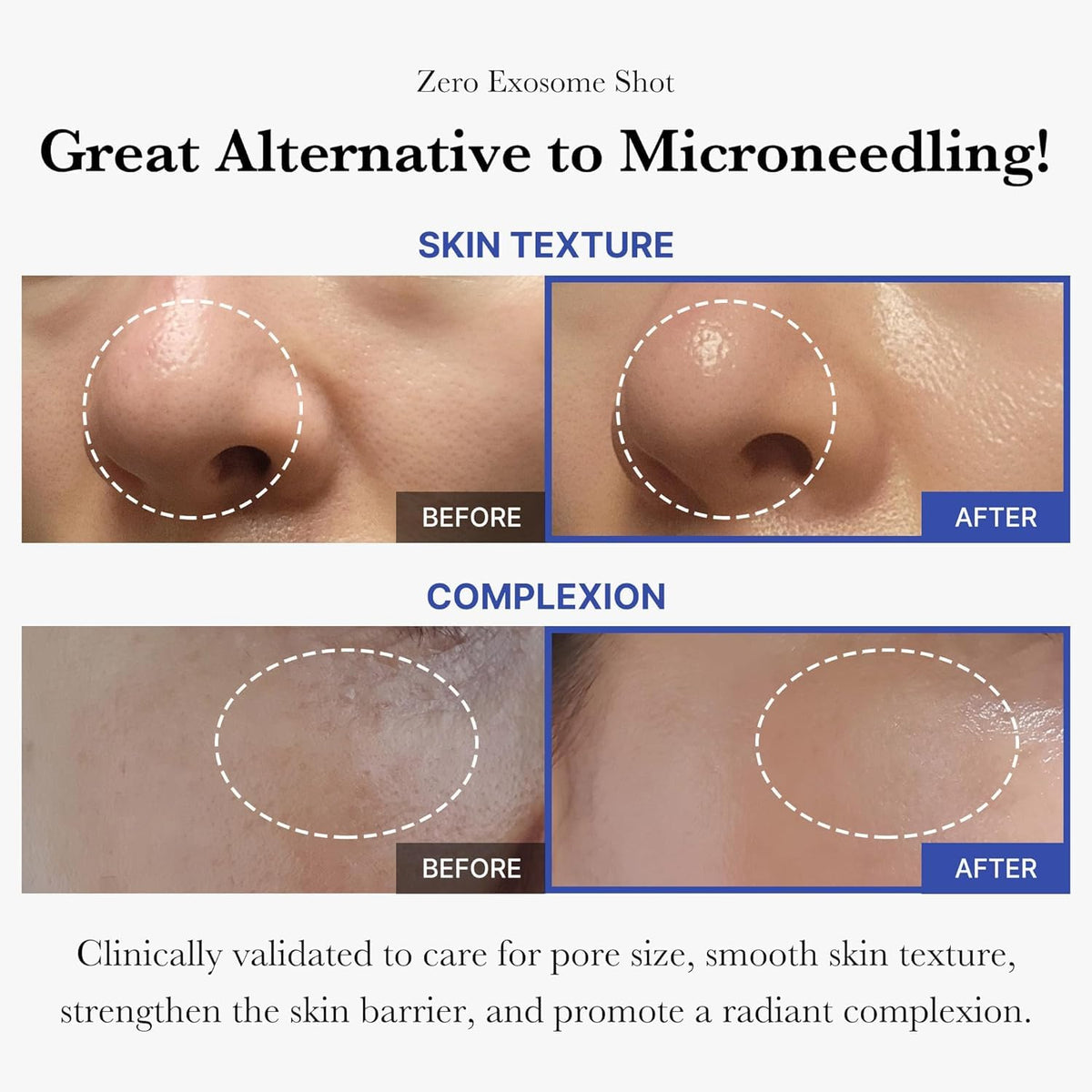 medicube Exosome Shot Zero Facial Serum packaging