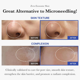 medicube Exosome Shot Zero Facial Serum packaging