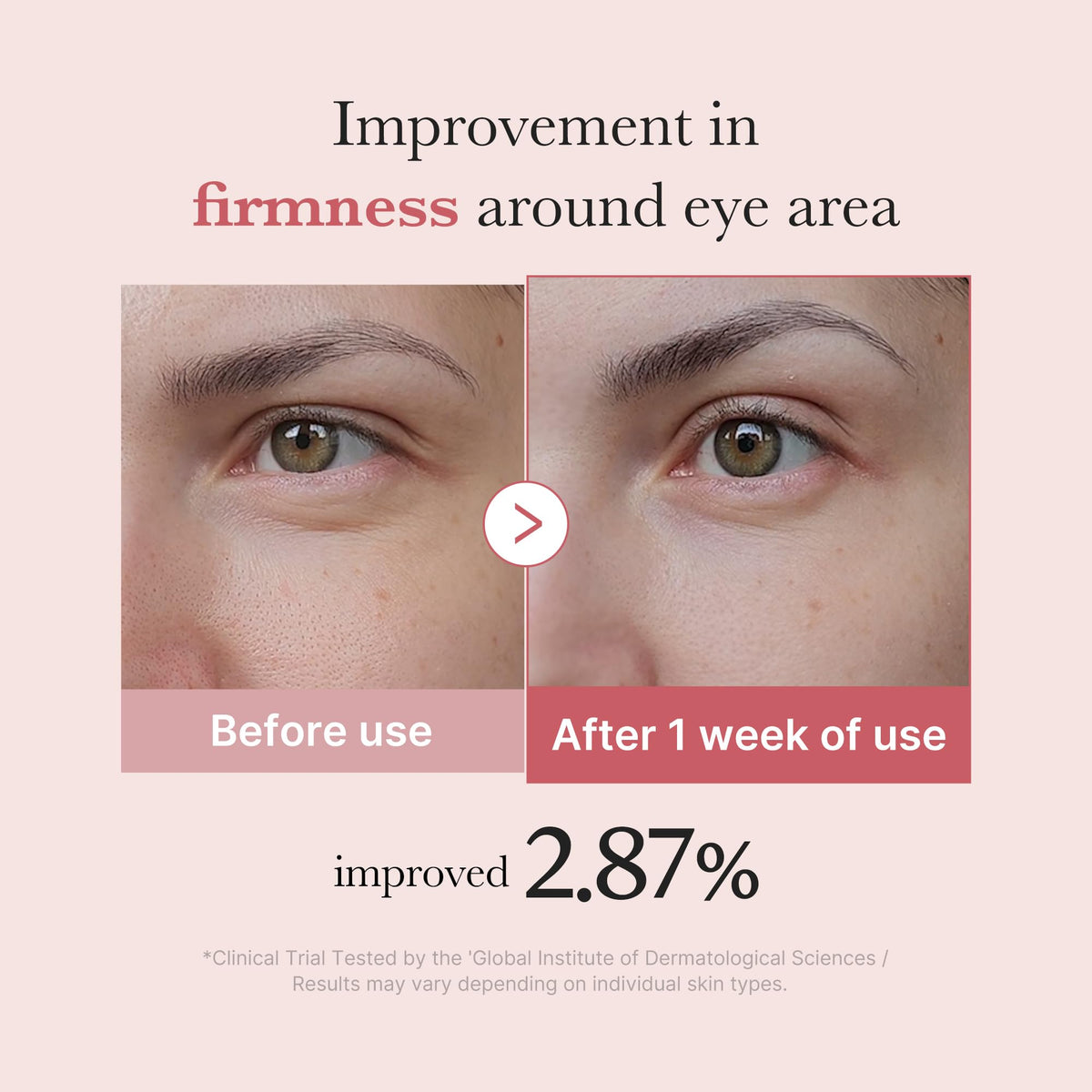 medicube Eye Serum application around the eye