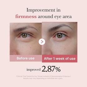 medicube Eye Serum application around the eye