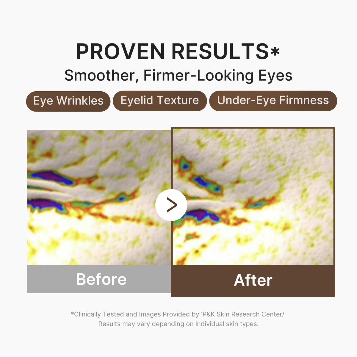 medicube Eye Serum texture on fingertip
