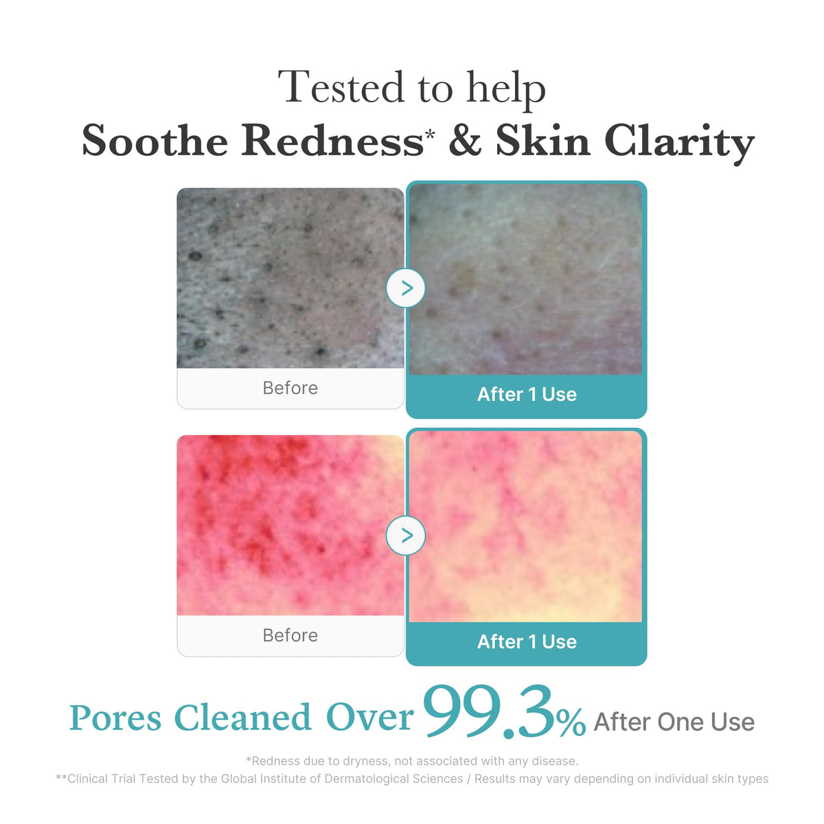medicube Facial Cleanser Azelaic Acid application on skin