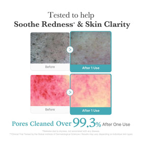 medicube Facial Cleanser Azelaic Acid application on skin