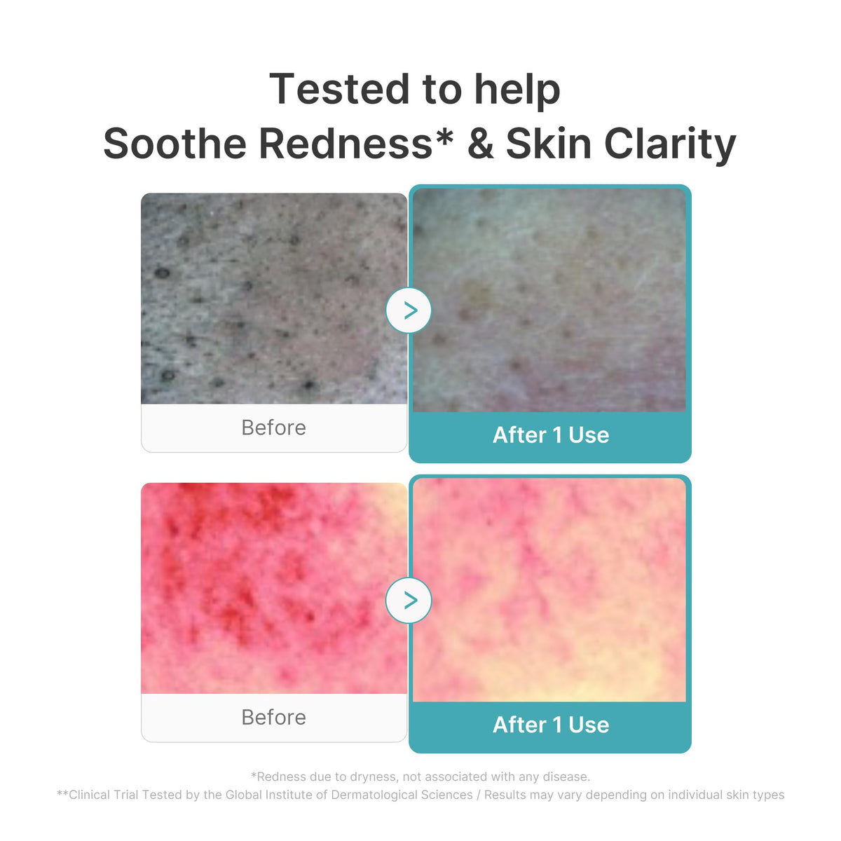 medicube Facial Cleanser Azelaic Acid Capsule Foam Cleanser application on skin