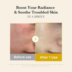 medicube Jelly Mist Serum in lifestyle setting