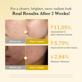 medicube Kojic Acid Turmeric Serum application on skin