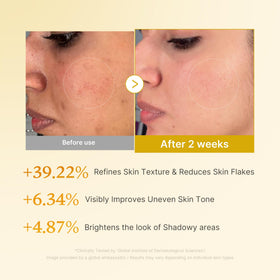 medicube Kojic Acid Turmeric Smoothing Toner in a lifestyle setting