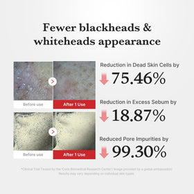 medicube Peel Shot 180g applied on skin for demonstration