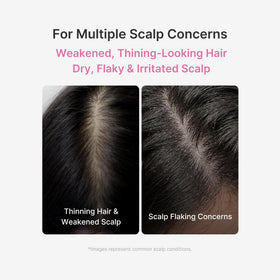 medicube Scalp Serum 20ml packaging