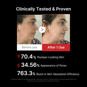 medicube support Pro in use with skincare products