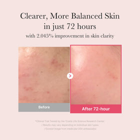 medicube TXA&Niacinamide 15% Glow Serum texture on hand