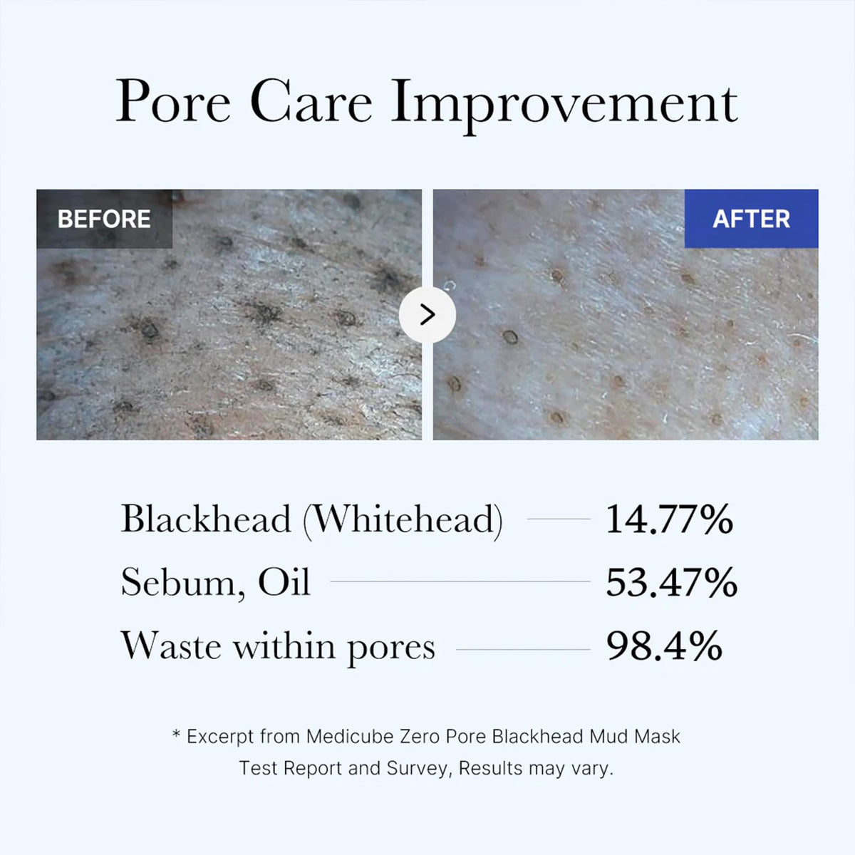 medicube Zero Pore Blackhead Mud Mask in use during skincare routine