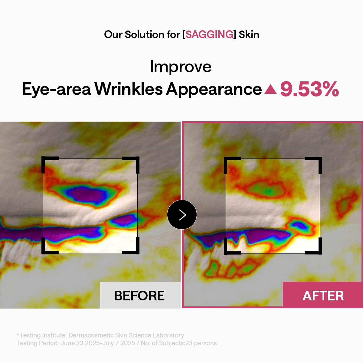 MEDIHEAL Retinol Collagen Capsule Eye Patches side view