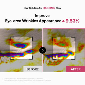 MEDIHEAL Retinol Collagen Capsule Eye Patches side view