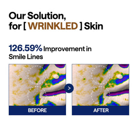 MEDIHEAL Retinol Collagen Lifting Pad being applied on skin