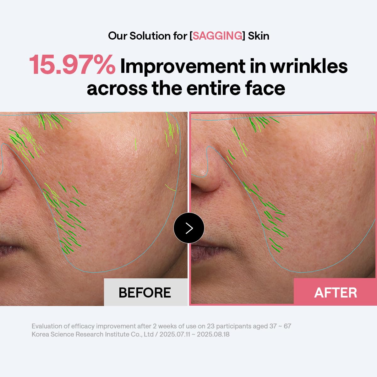 MEDIHEAL Retinol & Peptide Toner Pads in use on skin